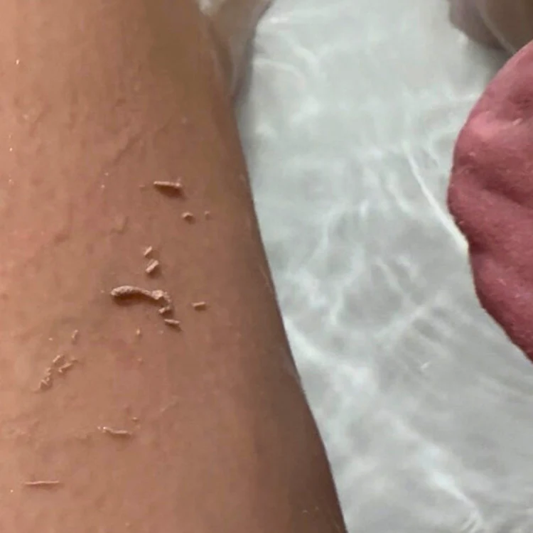 Zacht exfoliëren